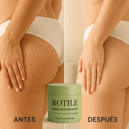 Rotile™ | Tu piel perdió su brillo, pero no su magia